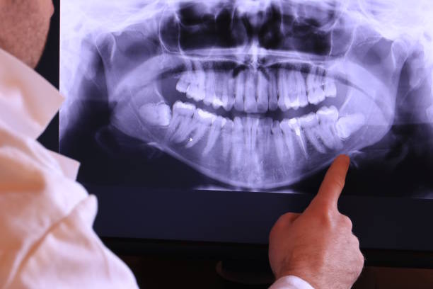 Best Emergency Root Canal Treatment in Fort Thomas, KY