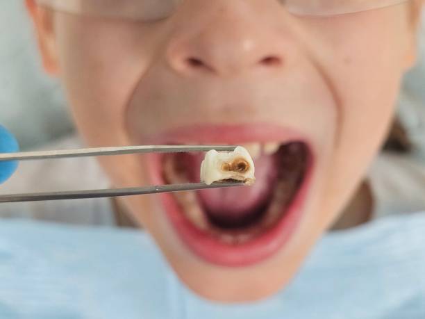 Best Pediatric Emergency Dentist in Fort Thomas, KY